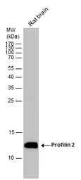 Profilin 2 antibody
