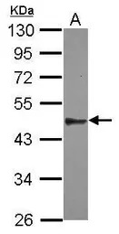 SPATA6 antibody [N1C1]
