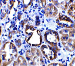 ACE2 antibody