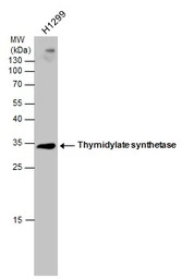 Thymidylate synthase antibody 