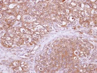 ARHGAP1 antibody [N3C3]