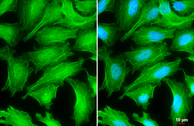 Tropomyosin 1 antibody