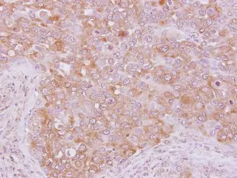 p190-B RhoGAP antibody