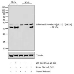 RPS6 (phospho Ser235/236) anti