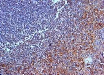 IL23 Receptor antibody, N-term