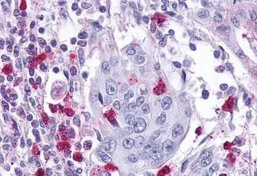 Leukotriene B4 Receptor antibo