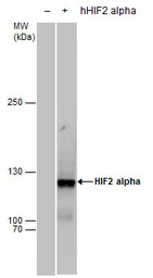 HIF2 alpha antibody