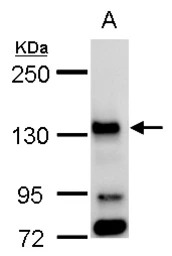 BUB1 antibody