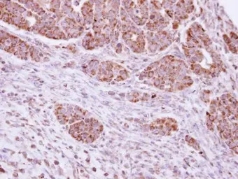 DUSP7 antibody [C1C3]