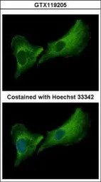 DNASE2B antibody [N1C3]