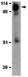 ACE2 antibody