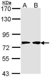 HADHA antibody [N2C1], Interna