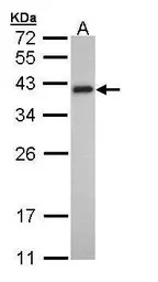 Tropomyosin 2 antibody [N1C3]