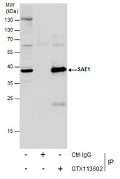 SAE1 antibody