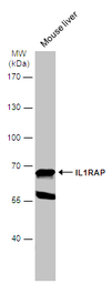 IL1RAP antibody [N1N3]