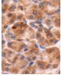 Chromogranin B antibody