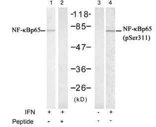 NFkB p65 (phospho Ser311) anti
