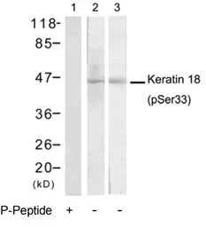 Cytokeratin 18 (phospho Ser33)