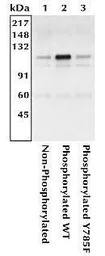 Integrin beta 3 (phospho Tyr78