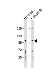 FGFR2 antibody, N-term
