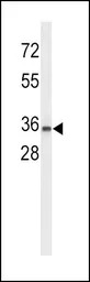 UPK1A antibody, C-term