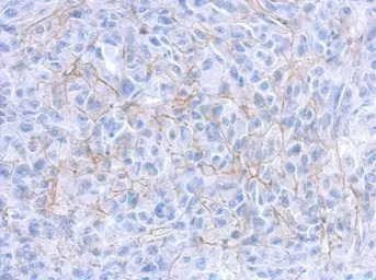 CD133 antibody [C1C2], Interna