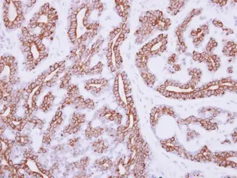 IL3 Receptor alpha antibody [N