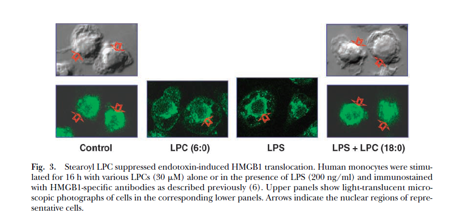 肉豆蔻酰溶血卵磷脂 M-LysoPC，高纯合成磷脂