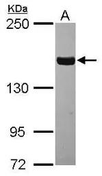 Tankyrase antibody