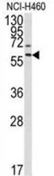 MMP17 antibody