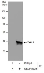 TXNL2 antibody [N2C3]