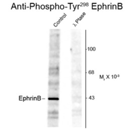 Ephrin B1 (phospho Tyr317) ant