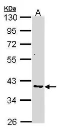 AKR7A2 antibody