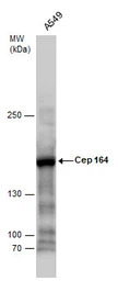 CEP164 antibody [17]
