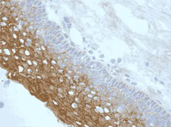 NLRP3 antibody [nalpy3-b]