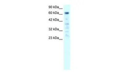 PARP3 antibody, C-term