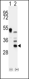 Apolipoprotein D antibody, N-t