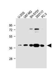 EN1 antibody, N-term