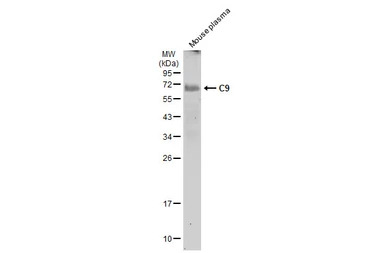 C9 antibody [N2C2-2], Internal
