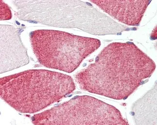 Tafazzin / TAZ antibody [C2C3]