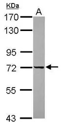 DDX43 antibody