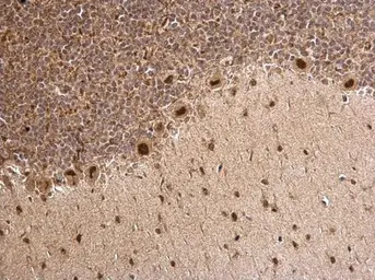 MTA1 antibody [C1C3]