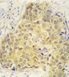 Semaphorin 3A antibody, Intern