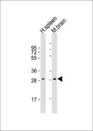 IL1 beta antibody, Internal