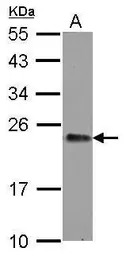 GNPNAT1 antibody [N1C3]