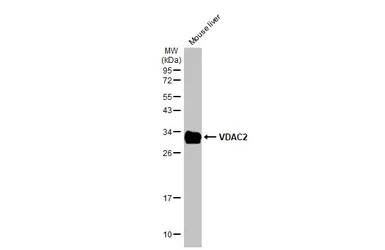 VDAC2 antibody [C2C3], C-term