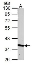 PRPS1 antibody