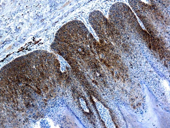 Human Papillomavirus type 16 L