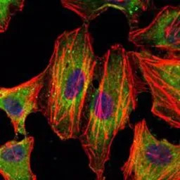 STAT3 antibody [3B5]