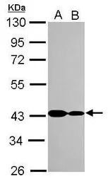 CARP antibody [N3C3]